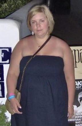 Catherine avant son opération